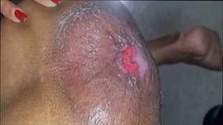 See My Stretched Ass After Cum-Filled Anal Prolapse
